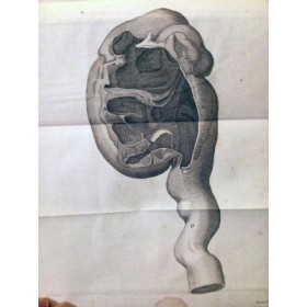 Traité des maladies vénériennes - Traduction de M. Audiberti